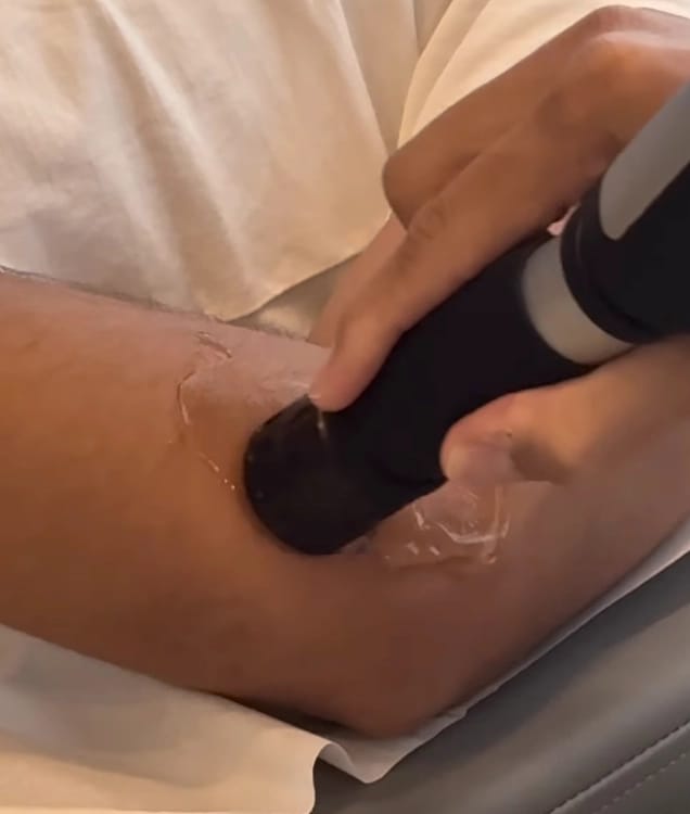 Extracorporeal Shock Wave Therapy (ESWT)